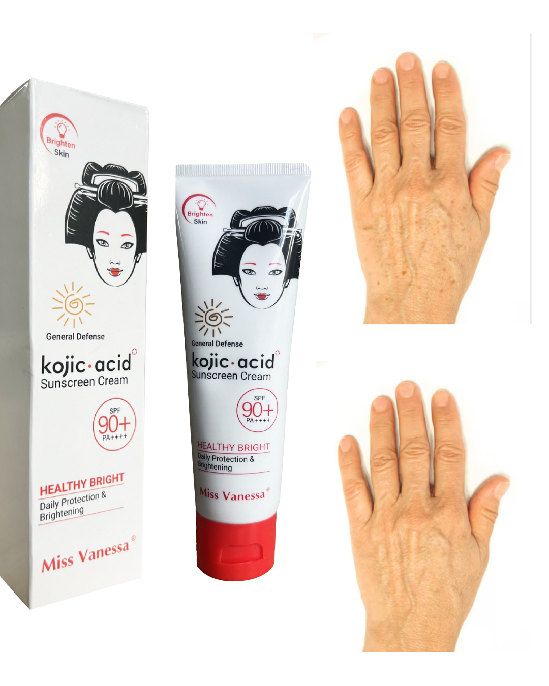 Protector Solar Despigmentante Manos de ácido kojico