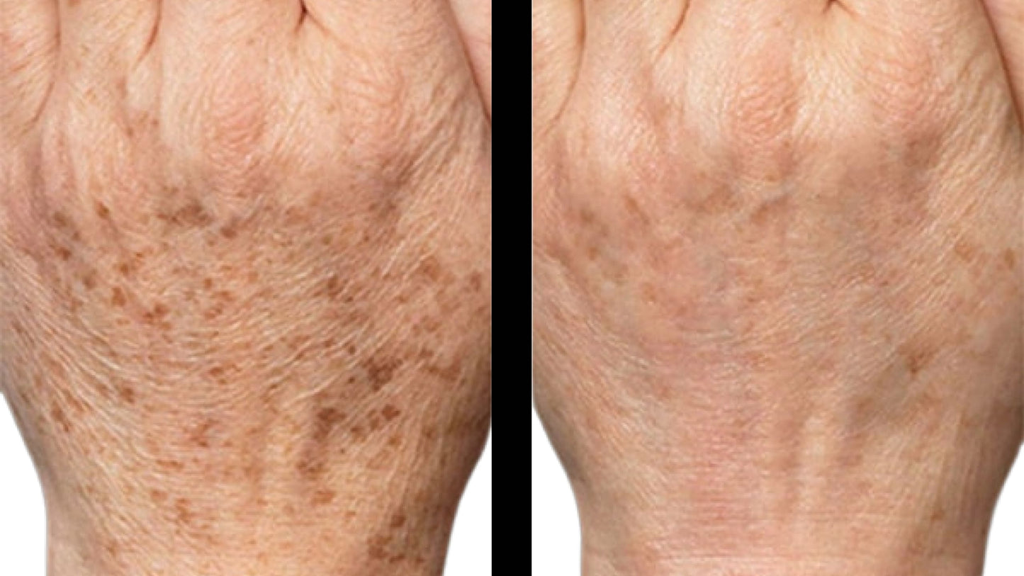 SERUM ACLARA MANCHAS OSCURAS DE ÁCIDO KÓJICO Y COLÁGENO